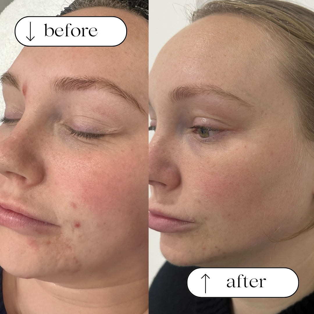 Before and after client result 1